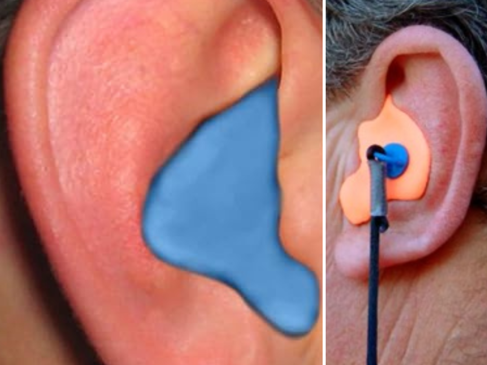 Molded ear plugs in an ear without a cord, and another with the cord.